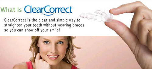 Zoom Teeth Whitening Treatment Results Before & After